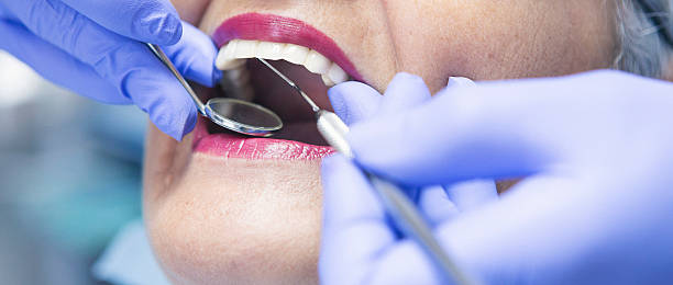 Best Dental Abscess Treatment in Watkins Glen, NY